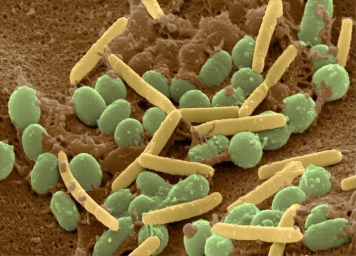 Почвенные бактерии вред и польза